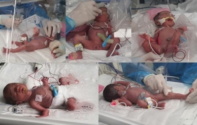 दक्षिण कोरिया में एक महिला ने दिया 5 बच्चों को जन्म